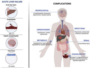 Systemic complications in acute liver failure. Created with Biorender.com