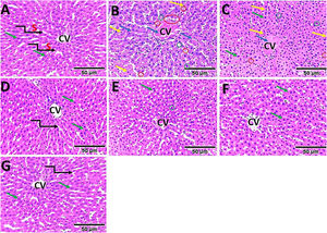 Representative light microscopy micrographs of liver sections with H&E staining. (A) Polyhedral hepatocytes with prominent central vein (cv), eccentrically placed rounded euchromatic nuclei with prominent nucleoli (green arrow), and endothelial cells lining the radially apparent sinusoids are shown. (B, C, and E) show features of cell degeneration, pyknosis (yellow arrow), hepatocellular vacuolation (green circle), hemorrhagic congestion in the central vein, sinusoidal dilatation (blue arrow), and areas of necrosis (red circle). (D, F, and G) show features similar to the controls, with rounded nuclei and prominent nucleoli (black arrow) and radially apparent sinusoids. Scaling bars – 50 μm.
