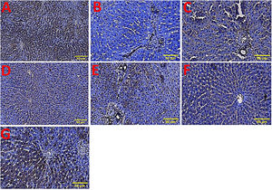 (A-G) Representative light microscopy micrographs of liver sections with pan-cytokeratin immunoreactivity. A, D, F, and G show diffuse, homogeneous cytoplasmic cytokeratin positive immunoreactivity (brown color). B, C, E show mild periductal positive immunoreactivity. Scaling bars – 50 μm.