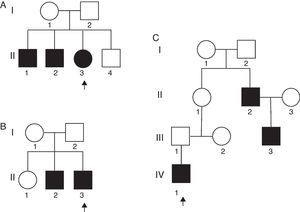 Genealogia dos três casos familiares (A, B, C) com o mesmo tipo de artrogripose múltipla congênita. As setas indicam os pacientes estudados. Os quadrados representam o sexo masculino e os círculos, o sexo feminino; os quadrados/círculos pretos representam os indivíduos afetados.
