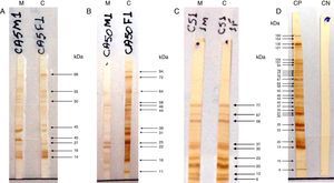 Reconhecimento padrão de proteínas de cepas RH de Toxoplasma gondii por anticorpos IgG com o método Western Blotting (IgG‐WB) em amostras de soro de mães com toxoplasmose adquirida durante a gravidez e seus filhos com suspeita de toxoplasmose congênita. A, IgG‐Western Blotting positivo para toxoplasmose congênita. Bandas iguais reconhecidas por anticorpos IgG com intensidade mais forte na amostra da criança em comparação com a amostra materna. B, IgG‐Western Blotting positivo para toxoplasmose congênita. Bandas diferentes reconhecidas por IgG da amostra da criança em comparação com a amostra materna. C, IgG‐Western Blotting negativo para toxoplasmose congênita. Bandas iguais reconhecidas por anticorpos IgG de amostras da criança e da mãe. M, mãe; C, criança; CP, controle positivo; CN, controle negativo.
