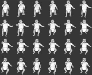 Captura de vídeo de um neonato de 14 semanas que apresenta movimentos irregulares ao longo do tempo, da esquerda para a direita e de cima para baixo. Foi usada uma taxa de frames de 12,5Hz que totalizou 1,92 s.