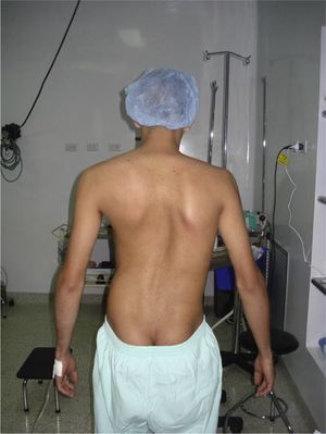 Image of the patient prior to the first surgery.