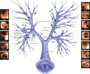 Bronchoscopy – airway anatomy.