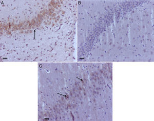 Hippocampal granular strata of different groups. (A) Neonatal rat in O2 control group – anti-caspase-3 positive marker (date). (B) Adult rat in the Oxygen behavior group, anti-caspase-3 market not positive. (C) Adult rat in the sevoflurane behavior group – mild anti-caspase-3 positivity (arrows). Bar scale 100μm.