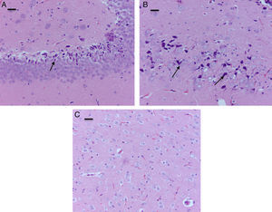 Moderate foci of neuronal death at the pyramidal level. (A) HE staining. Section of the hippocampus of a rat in the sevoflurane behavior group. Moderate neuronal death foci can be observed. (B) HE staining. Section of the hippocampus of a rat in the sevoflurane behavior group. Moderate neuronal death foci can be noted (arrows), (C) HE staining of the thalamus of an animal in the sevoflurane behavior group; no neuronal death foci can be seen. Bar scale 25μm.