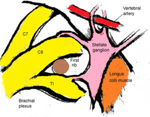 The stellate ganglion lateral longus Colli muscle and closely related to the brachial plexus, and the lower portion is situated back to the origin of the vertebral artery.