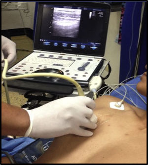 Pulmonary ultrasound.