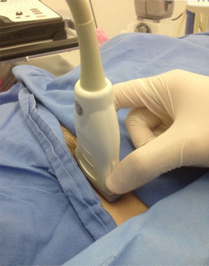 Pinch grip of the transducer.