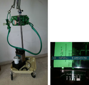Bird Mark 7 ventilator and ultrasonic nebulizer used in Mr. Villegas’ care. Above: the name of the owner, Dr. Sarmiento.