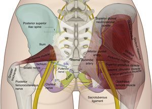 Gluteal anatomy and recommended position for the ultrasound transducer for assessment: (1) at the level of the postero-superior iliac spine; (2) at the level of the greater sciatic foramen; (3) at the level of the ischial spine; and (4) medial to the ischial spine.