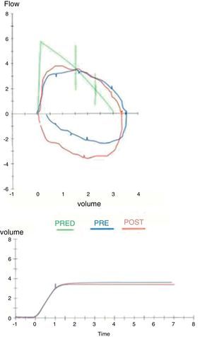 Pre and post bronchodilator spirometry. Source: Authors.
