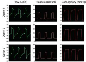 Simulation of mandatory ventilation in a healthy patient. The 3 models studied maintained NIV pressure settings and prevented CO2 rebreathing.