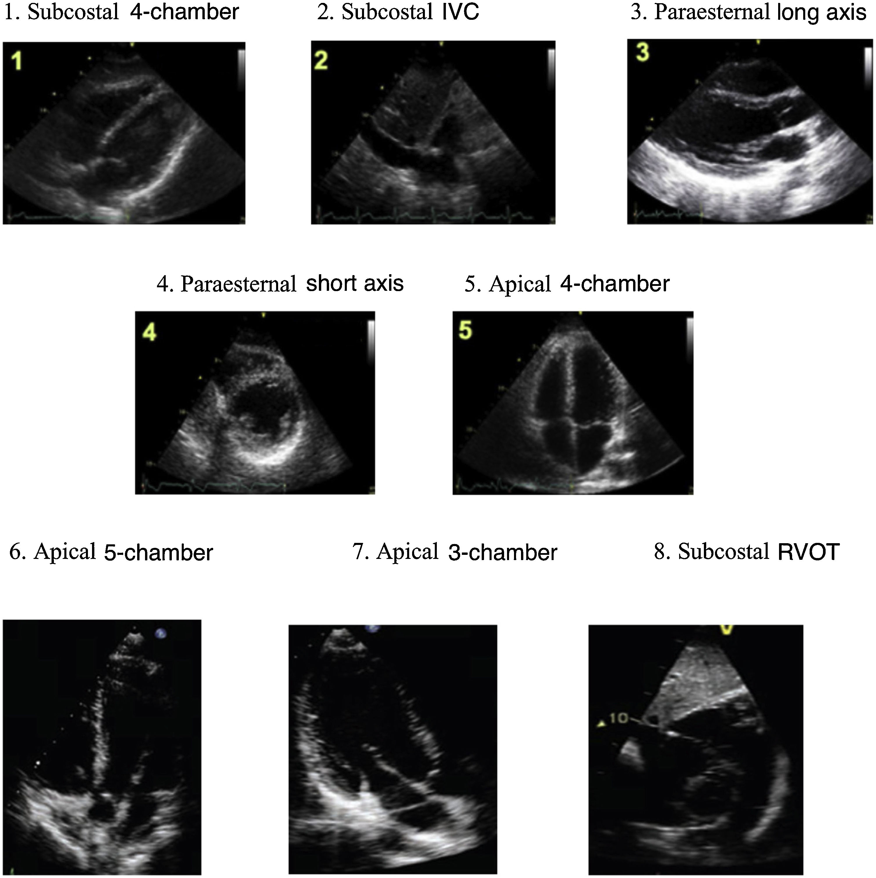Diploma on Basic Echocardiography training and competencies for ...