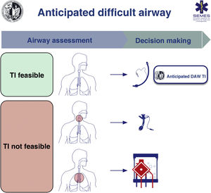 Cognitive aid to facilitate decision-making in the management of anticipated difficult airway. TI: tracheal intubation; DAW: difficult airway.