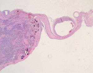 Microscopic view of the placenta.