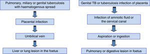 Routes of transmission for congenital tuberculosis.