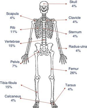 Distribution and percentage of bone lesions.