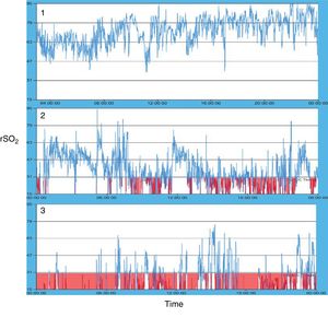 Types of oximetry patterns observed during 24-h monitoring in the patients under study.