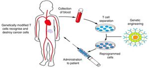 Production and delivery of CAR T cells. Lymphocytes are harvested from the patient by means of leukapheresis. Ex vivo, T cells are separated, expanded and genetically modified to express a chimeric antigen receptor (CAR) that recognises a tumour antigen (CD19 in the case of CART-19), and then are infused back into the patient.