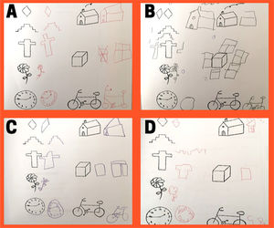 Assessment of graphomotor skills through drawing. Pascual graphomotor test. A) Age 7 years. Test score: 100. Normal neurodevelopment, no ADHD. B) Age 6 years. Test score: 127. No neurologic impairment. High level for age. C) Age 7 years. Test score: 74. Neurologic impairment, no ADHD. D) Age 6 years. Test score: 66. Neurologic impairment, ADHD. ADHD, attention-deficit hyperactivity disorder.