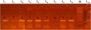 Polymerase chain reaction (PCR-ARMS) products of amplification of the EDN1 rs5370 locus, with identification of the GT genotype (lanes 3–6, 9, 10) and the GG genotype (lanes 1, 2, 7, 8); lane M corresponds to the DNA marker.