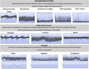 Classification of background, sleep-wake cycling and seizure patterns in amplitude-integrated electroencephalographic traces.1,5 aContinuous normal voltage: continuous activity in a narrow bandwidth with a minimum amplitude of more than 5 μV and a maximum between 10–50 μV. Discontinuous normal voltage: discontinuous activity in a broader bandwidth with minimum amplitude variable but of less than 5 μV and a maximum amplitude greater than 10 μV. Burst suppression: discontinuous background with amplitude in a narrow bandwidth without variation between 0 and 2 μV and bursts with amplitude greater than 25 μV. Continuous low voltage: continuous background pattern of very low voltage with a lower amplitude of less than 5 μV and a maximum of less than 10 μV. Inactive or flat trace: isoelectric tracing with background pattern under 5 μV. b Developed SWC: clearly identifiable sinusoidal changes between discontinuous and more continuous background in the aEEG with a cycle duration of at least 20 min; imminent/immature SWC: some, but not fully developed, cyclic variation of the lower border; absent SWC: no sinusoidal variations of the background trace. c Single seizures: maximum of 1 seizure per hour; repetitive seizures: 2 or more seizures per hour; status epilepticus: continuously ongoing repetitive seizures or a single seizure lasting at least 30 min.