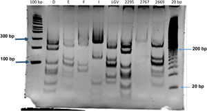 Restriction fragment length polymorphism from Chlamydia trachomatis ompA gene of type strains and isolated from bronchial aspirates of newborns with respiratory distress. Type strains (D, E, F and I); bronchial aspirate samples (2295, 2767, 2669), Molecular size marker (100 bp and 20 bp).