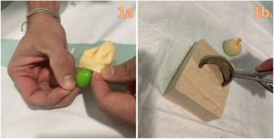 Construction of the ultrasound-guided pericardiocentesis model using tofu. (a) Fill a small balloon (5cm diameter) with saline solution and insert it in a larger one (8cm diameter), fill this second balloon with saline using a 50mL syringe. (b) Open a package of firm tofu and make a hole with an ice-cream scoop.