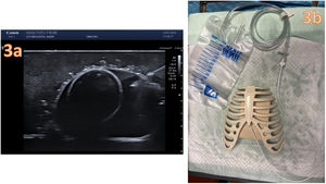 Construction of the ultrasound-guided pericardiocentesis model using tofu. (a) Ultrasound-guided pericardiocentesis. (b) Completely set-up pericardiocentesis kit.