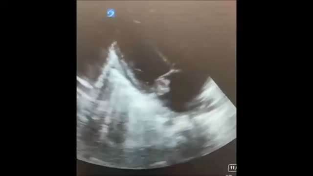 https://ars.els-cdn.com/content/image/1-s2.0-S2341287923002041-mmc1.mp4