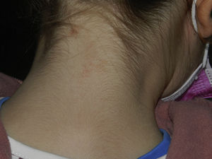 Six months after finishing treatment.