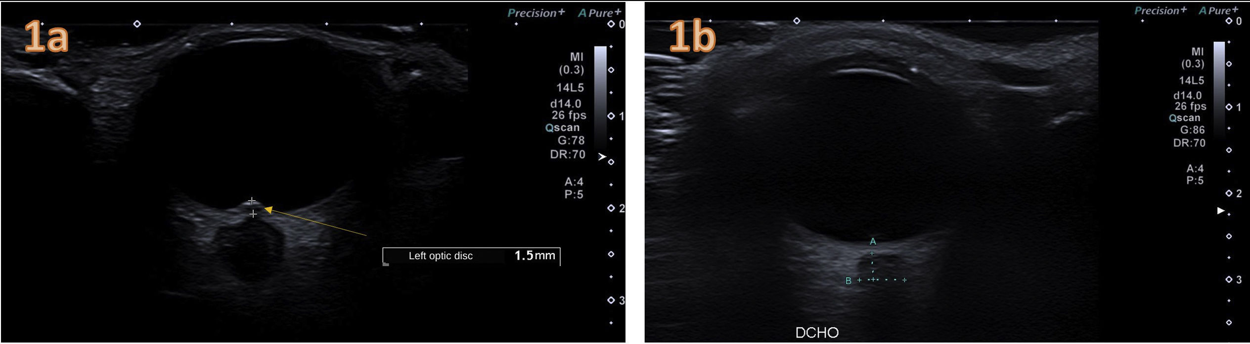 fig0005