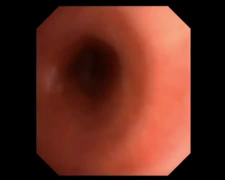 https://ars.els-cdn.com/content/image/1-s2.0-S2341287925000857-mmc1.mp4