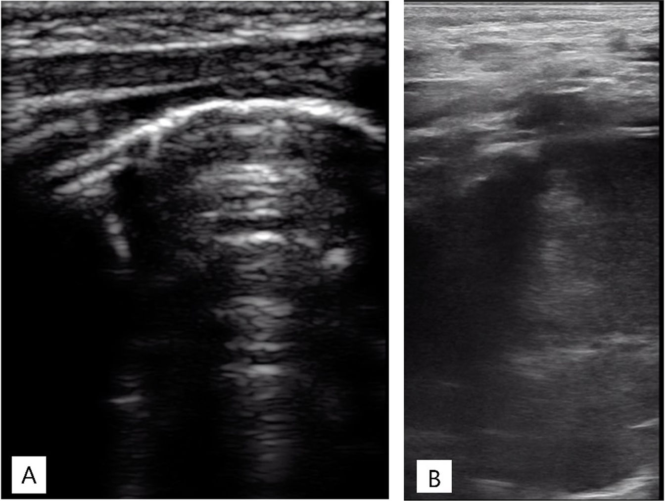 fig0010