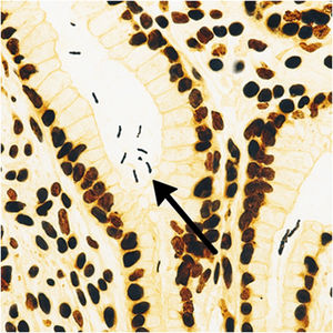 Presence of Helicobacter-like spiral-shaped bacteria, compatible with H. heilmannii (Warthin-Starry, original magnification ×40).