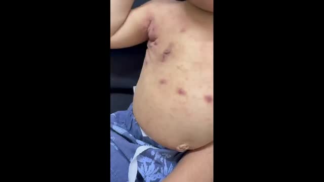 https://ars.els-cdn.com/content/image/1-s2.0-S2341287925002157-mmc1.mp4