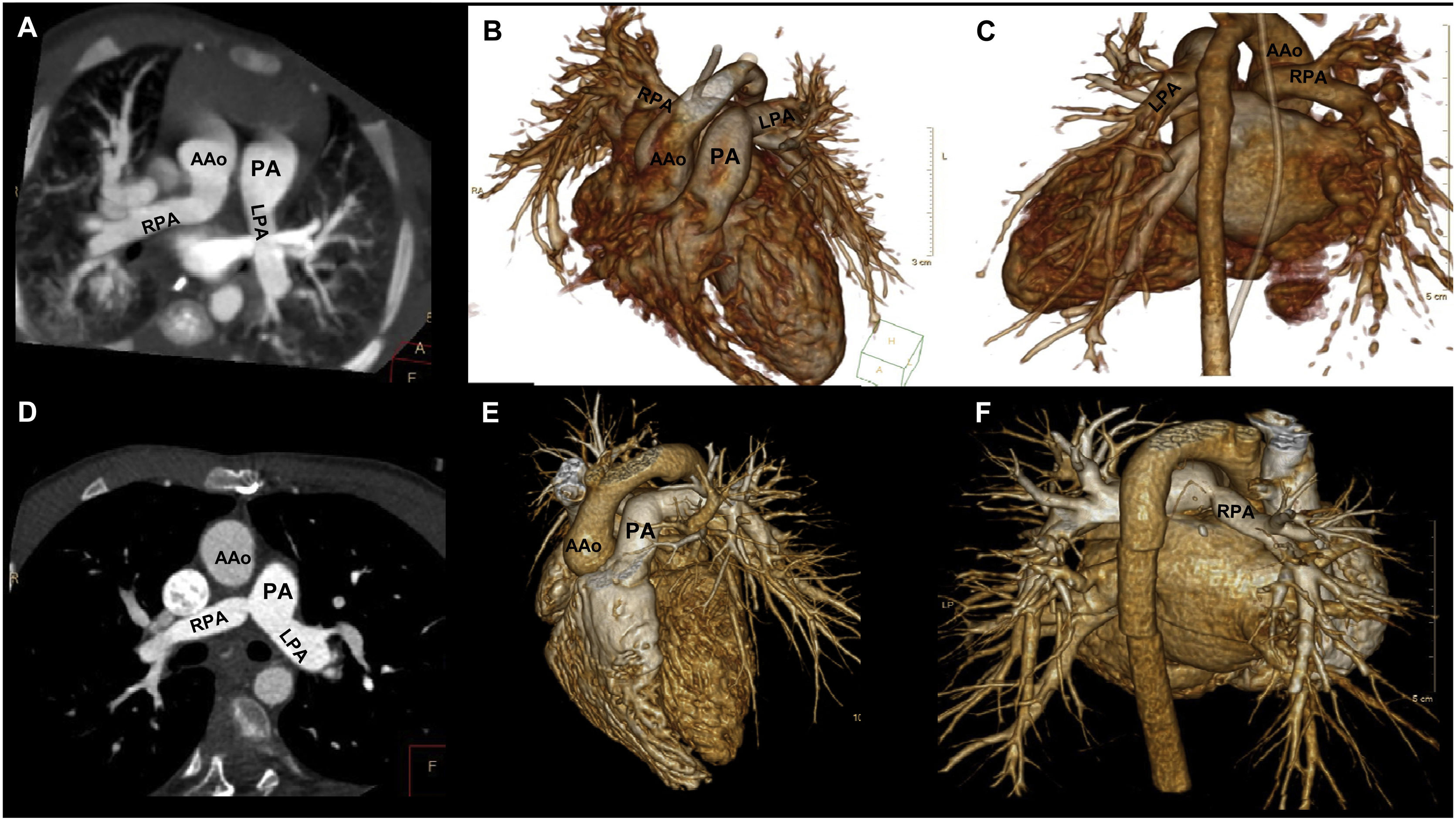fig0010