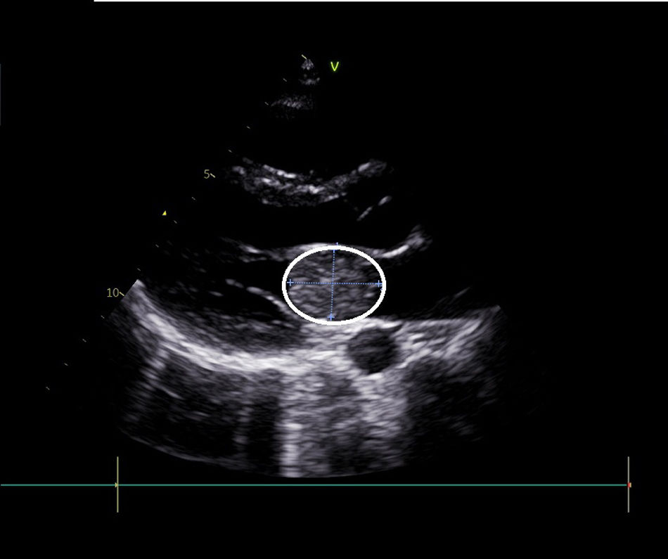 fig0005