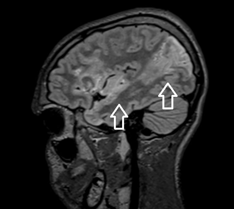 fig0015