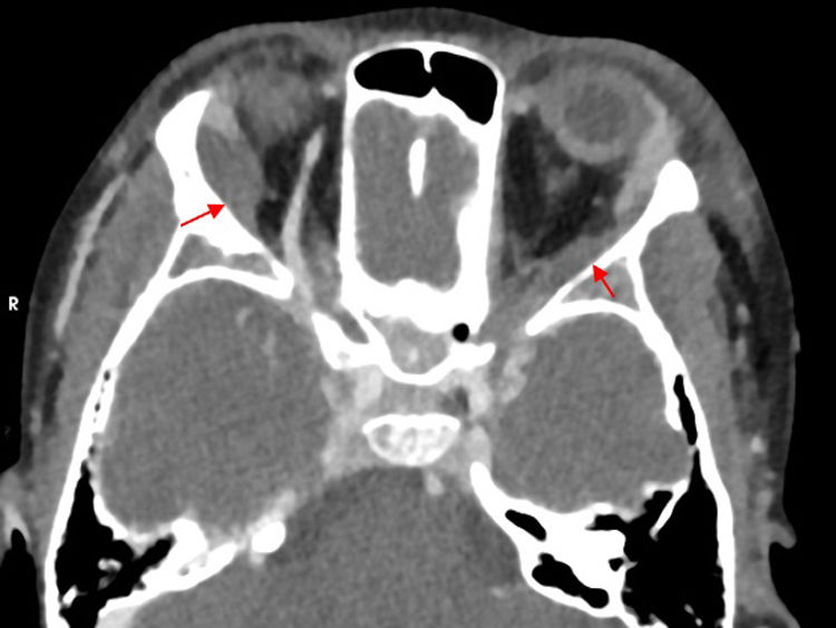 fig0010