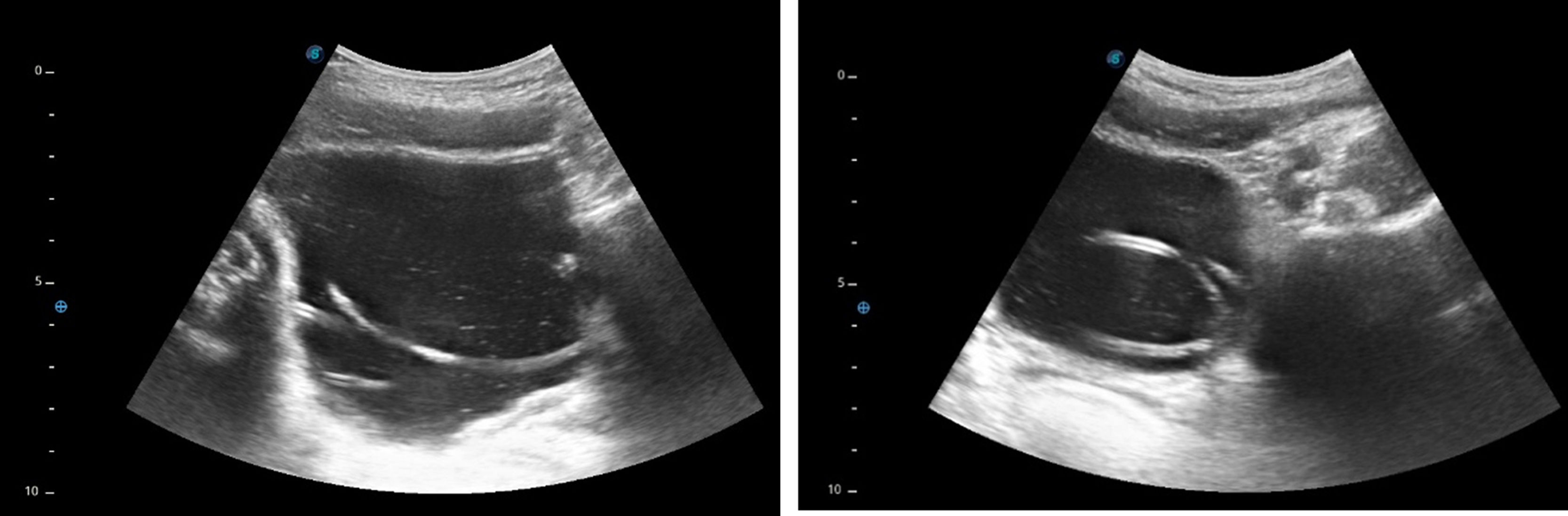 fig0005