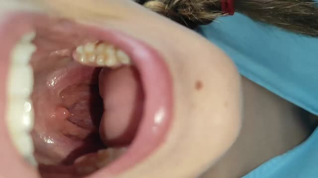 https://ars.els-cdn.com/content/image/1-s2.0-S2341287926000748-mmc1.mp4