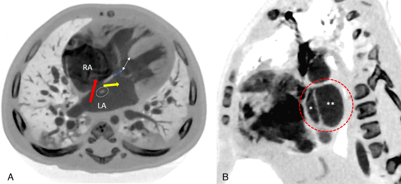 fig0005