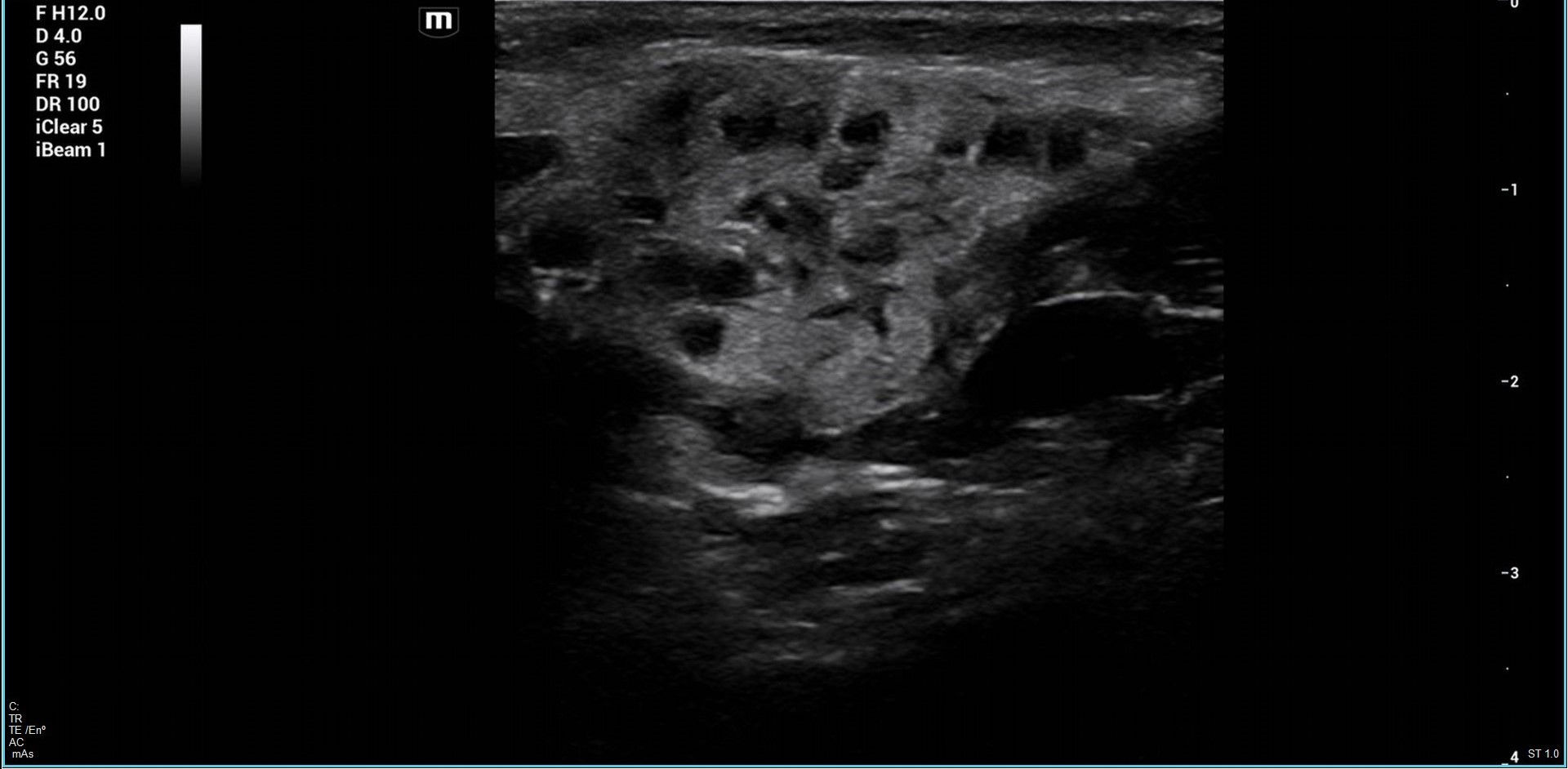 fig0005