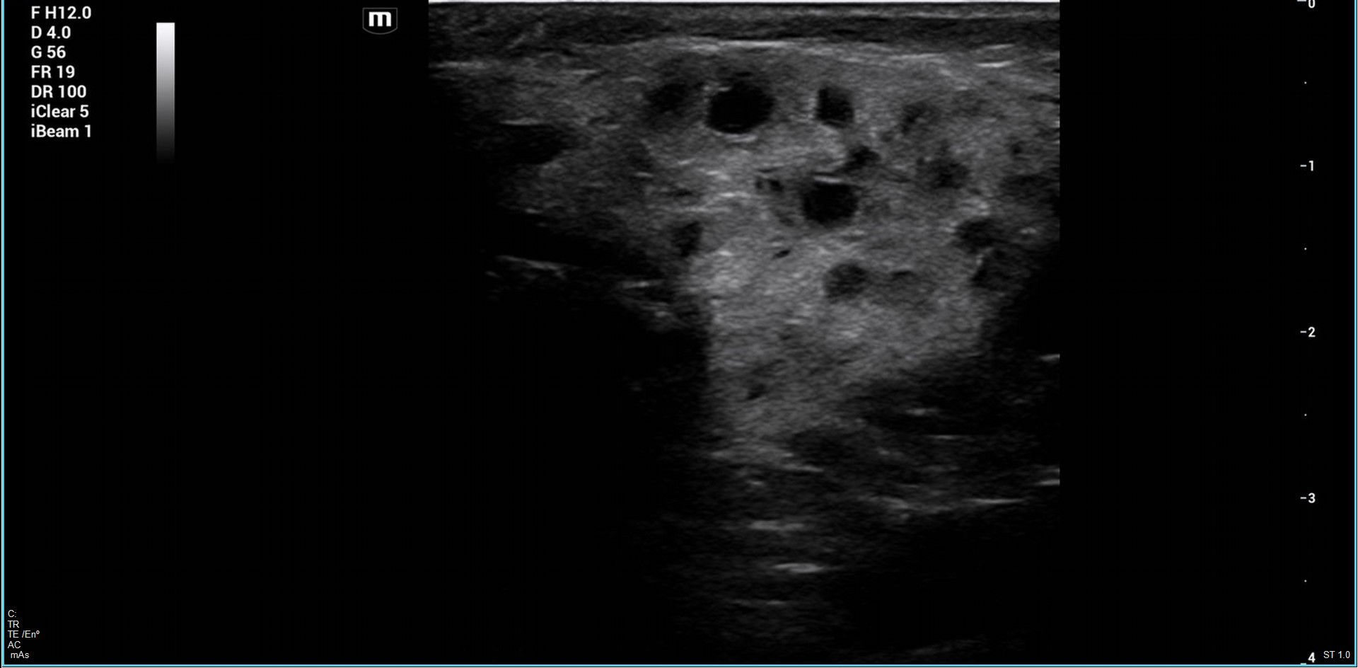 fig0010