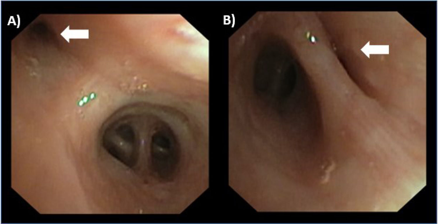 fig0015