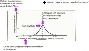 Tympanogram curve (generated by authors).