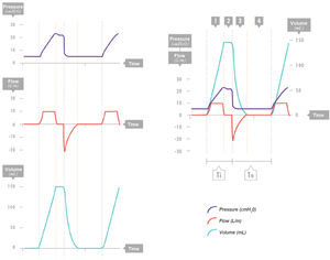 Volume control. Combined view of the three waveforms. Segment 1: Inspiratory phase with constant flow: constant inflow with a progressive increase in pressure and volume gain. Segment 2: Pause. No air enters or exits (zero flow). The pressure drops to a plateau value, and the volume remains constant. Segment 3: Expiration. Volume exits and pressure drops to the positive end-expiratory pressure (PEEP) level, with negative expiratory flow. Segment 4: Zero-flow expiratory phase (it is important that there be sufficient time for the inhaled air to be exhaled); the PEEP and volume remain constant. Te: expiratory time; Ti, inspiratory time.