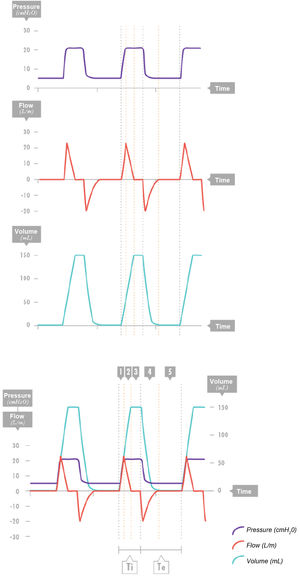 Pressure control. Combined view of the three waveforms. Segment 1: Segment 1: delivery of peak inspiratory flow achieving a specific pressure. Segment 2: The flow decelerates while maintaining a nearly constant pressure in the system. Segment 3: Once the pressures of the ventilator and the lungs equilibrate, gas no longer enters the lungs, so the flow is 0. This is not considered a programmed pause. Segment 4: Effective expiration. Volume is expired, pressure drops to the positive end-expiratory pressure (PEEP) level, and negative expiratory flow occurs. Segment 5: Zero-flow phase at end of expiration (it is important that there be sufficient time for the inspired air to be exhaled); there are no changes in PEEP or volume. Te: expiratory time; Ti, inspiratory time.